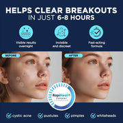 Pimple Patches for Face - 134 Count Hydrocolloid Acne Patches - Zit, Blemish, Cystic Acne Dots & Dark Spot Treatment - Invisible Clear Pimple Patch Stickers for Forehead, Chin, Nose, 3 Sizes (S, M, L) - Creatique