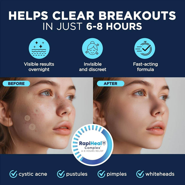 Pimple Patches for Face - 134 Count Hydrocolloid Acne Patches - Zit, Blemish, Cystic Acne Dots & Dark Spot Treatment - Invisible Clear Pimple Patch Stickers for Forehead, Chin, Nose, 3 Sizes (S, M, L) - Creatique